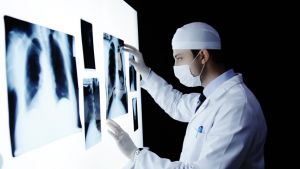 Υψηλά ποσοστά πρόωρου θανάτου από χρόνιες παθήσεις στην Ελλάδα