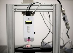 Μεταμόσχευση νεφρού σε ασθενή με σπάνιο μεταβολικό σύνδρομο