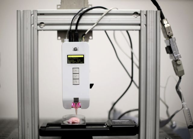 Μεταμόσχευση νεφρού σε ασθενή με σπάνιο μεταβολικό σύνδρομο