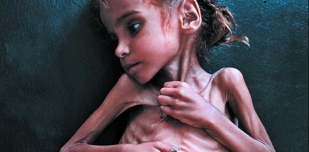 «Η τραγωδία του πολέμου της Σαουδικής Αραβίας»