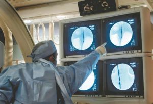 Σκλήρυνση Κατά Πλάκας: Η έγκαιρη έναρξη θεραπείας μειώνει την εξέλιξη της αναπηρίας