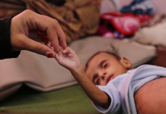Θερίζει ο λιμός στην Υεμένη με θύματα περίπου 85.000 παιδιά