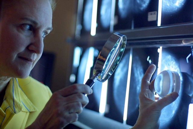 Κερδίζει έδαφος στη διάγνωση του καρκίνου η ψηφιακή μαστογραφία