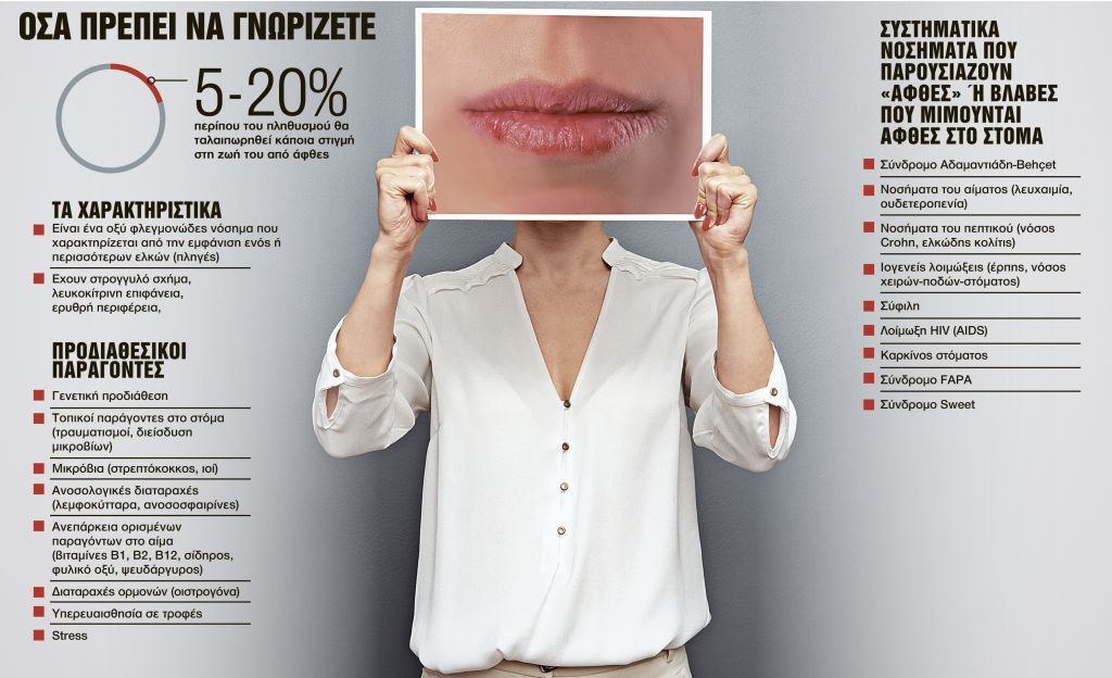 Αφθες: το πιο συχνό νόσημα του στόματος