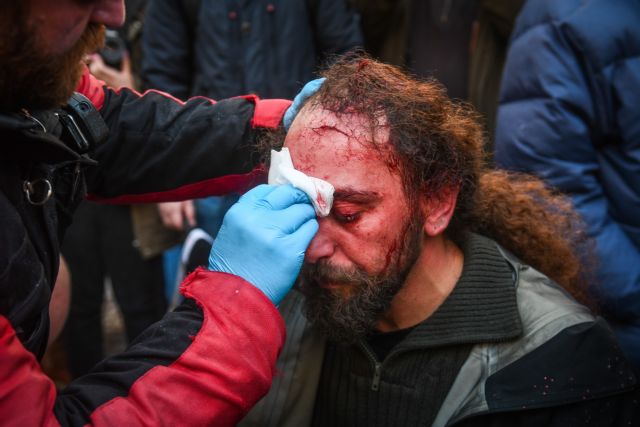 Πήγαν να σκοτώσουν φωτορεπόρτερ για να του πάρουν την κάμερα