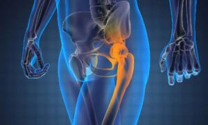 Θέμος : Το είδος του καρκίνου που νίκησε τον γνωστό δημοσιογράφο