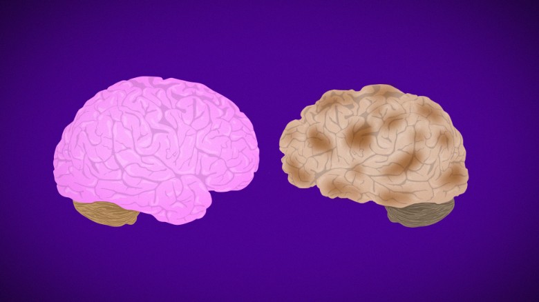 Ο γυναικείος εγκέφαλος φαίνεται νεότερος από ό,τι των ανδρών της ίδιας ηλικίας