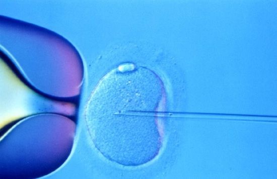 Η εξωσωματική γονιμοποίηση εγκυμονεί επιπλοκές στην κύηση | tanea.gr