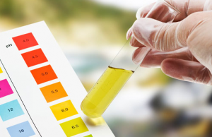 Τεστ ούρων που μπορεί να διαγνώσει τον επιθετικό καρκίνο του προστάτη