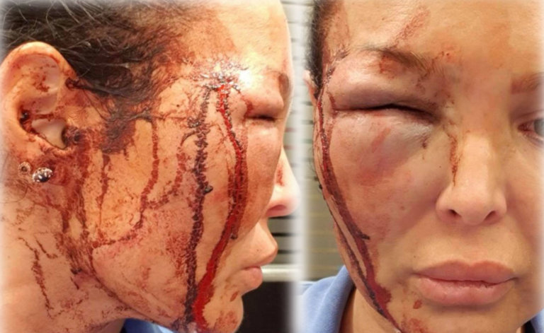 «Ο Μανώλης Παπαμακάριος με χαράκωσε και με γρονθοκόπησε»