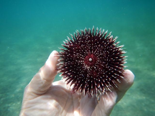 Τι πρέπει να κάνεις αν το παιδί πατήσει αχινό