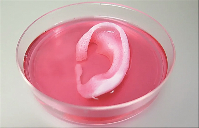 Τρισδιάστατη εκτύπωση ανθρώπινου αφτιού