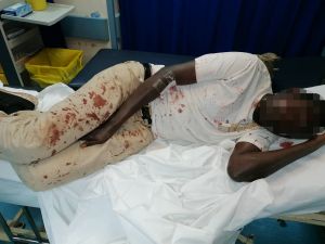 Ρατσιστική βία στην Ελλάδα: Τα περιστατικά συνεχίζονται…