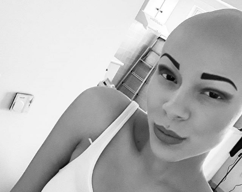 To κορίτσι του GNTM που συγκίνησε με την ασθένειά της