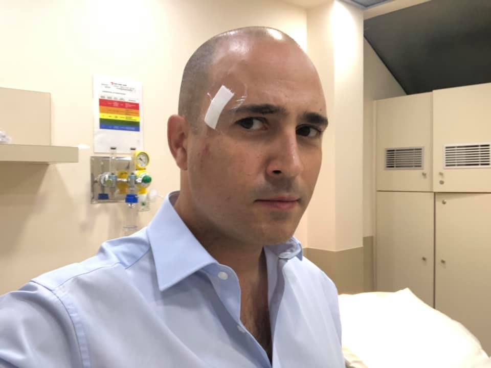 Ράμματα στο κεφάλι για τον Μπογδάνο λόγω… βροχής