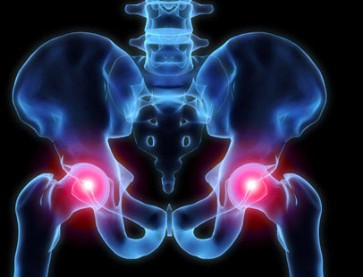 Κάταγμα στο ισχίο : Η ημιαρθροπλαστική μπορεί να έχει το ίδιο καλά αποτελέσματα με την ολική