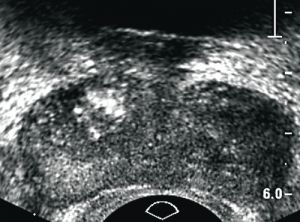 Ο ακατέργαστος φόβος της διπλανής πόρτας