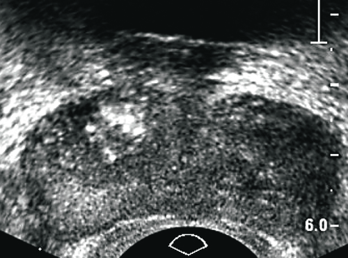 Ο ακατέργαστος φόβος της διπλανής πόρτας
