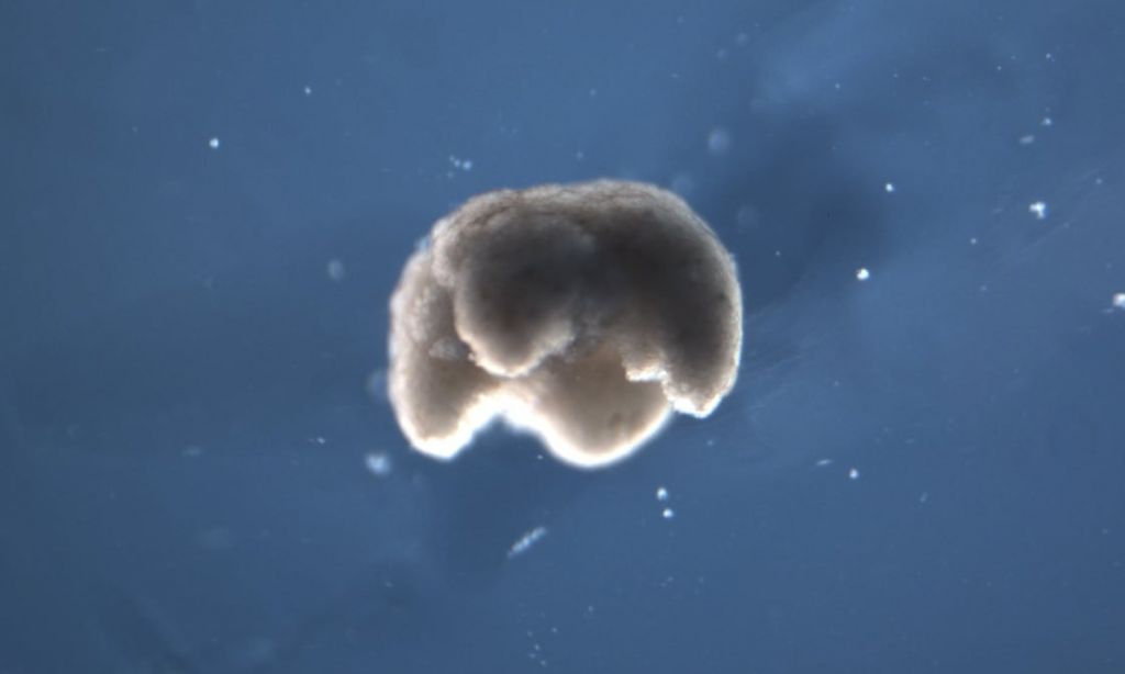 Έτοιμα τα πρώτα ζωντανά ρομπότ – Κινούνται μόνα τους, μεταφέρουν φάρμακα στο σώμα, αυτοθεραπεύονται