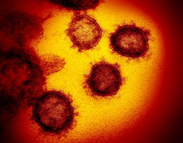Κορωνοϊός: Νέα απεικόνιση του θανατηφόρου ιού – Μοιάζει με τον SARS