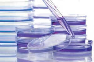 Καρκίνος : Έως και 35 χρόνια πριν τη διάγνωση οι «ένοχες» μεταλλάξεις γονιδίων