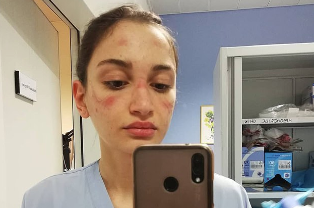 Ιταλία: Συγκλονιστικές μαρτυρίες νοσηλευτριών για τον αγώνα που δίνουν