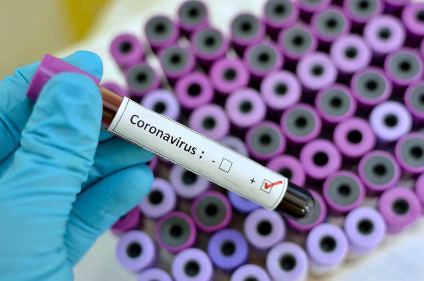 Κοροναϊός : Νέο τεστ ανίχνευσης του ιού θα δίνει άμεσα το αποτέλεσμα