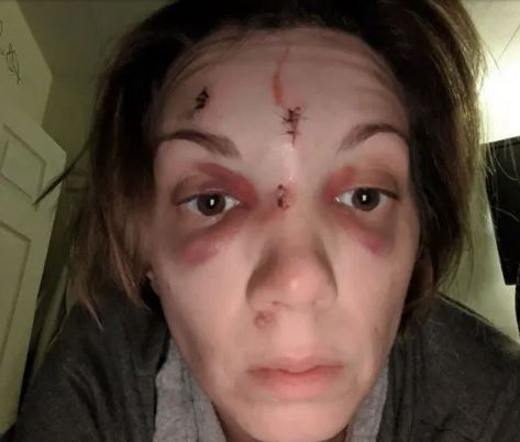 Η βία έχει ανοσία στον κοροναϊό: Γυναίκες δείχνουν το πρόσωπό τους και στέλνουν ένα δυνατό μήνυμα