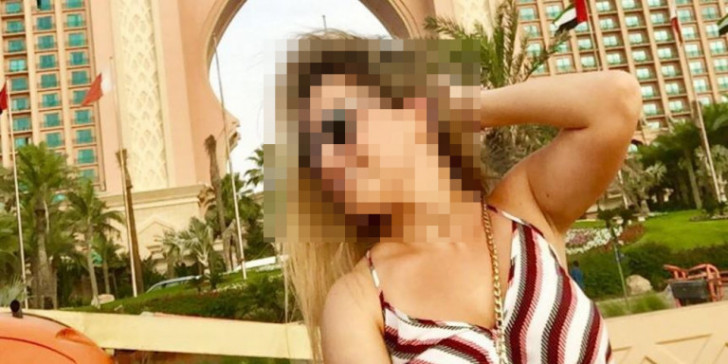 Επίθεση με βιτριόλι: «Πότε θα την πιάσουν;» ρωτά συνεχώς η 34χρονη