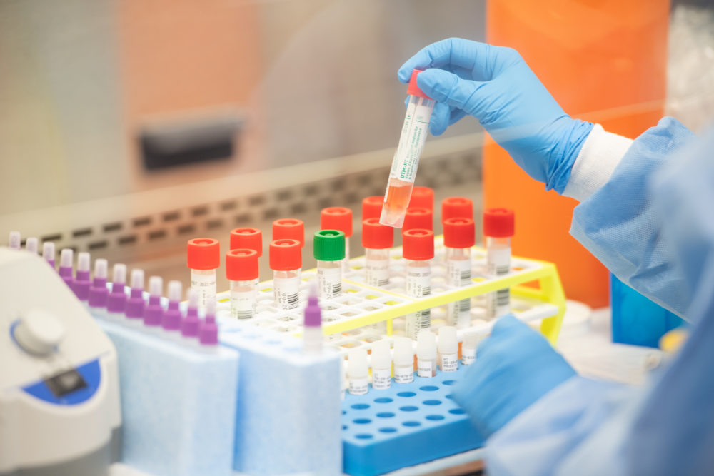 Ινστιτούτο Παστέρ : Τον Οκτώβριο τα πρώτα αποτελέσματα εμβολίου για τον κοροναϊό
