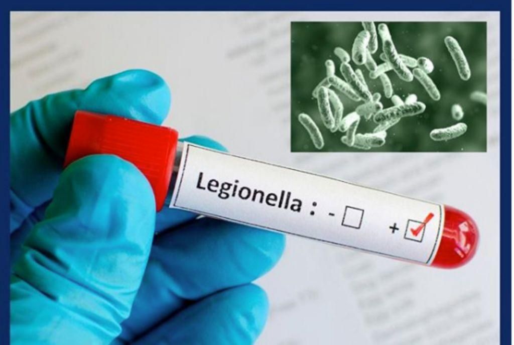 Οσα πρέπει να γνωρίζετε για τη νόσο των Λεγεωνάριων που προκαλεί το κλιματιστικό