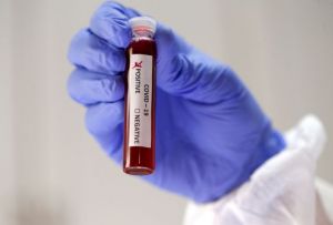 Αρχισε η διεξαγωγή τεστ αντισωμάτων σε επαγγελματίες της υγείας κι εργαζόμενους του ΕΣΥ