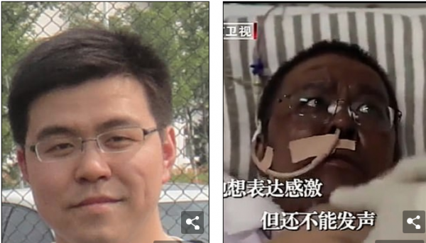 Πέθανε o δρ. Χου, ο κινέζος γιατρός που είχε μαυρίσει το δέρμα του από τον κοροναϊό