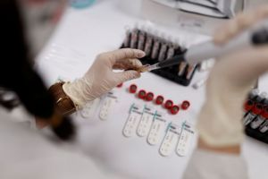 Ενθαρρυντικά τα αποτελέσματα της κολχικίνης – Μειώνει τις πιθανότητες διασωλήνωσης