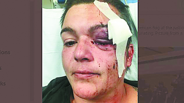 Χτυπούν για εκφοβισμό τους ρεπόρτερ που καλύπτουν τις ταραχές