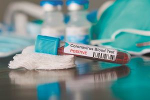 Ξάνθη : Κλείνουν για 10 μέρες τέσσερα δημοτικά μετά από κρούσμα σε εκπαιδευτικό