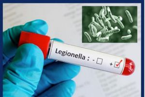 Οσα πρέπει να γνωρίζετε για τη νόσο των Λεγεωνάριων που προκαλεί το κλιματιστικό