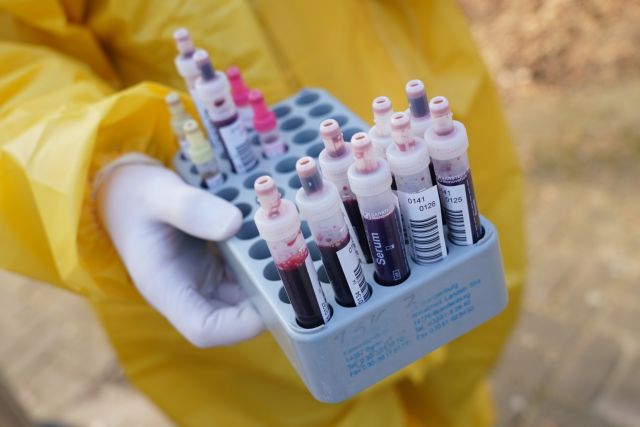 Πρωτοποριακό τεστ εντοπίζει καρκινικούς όγκους μέσω αιματολογικής εξέτασης