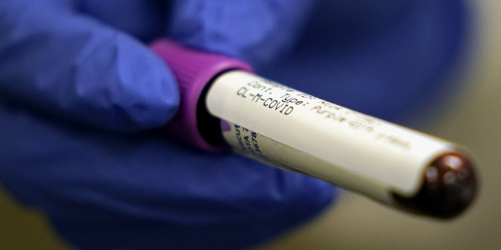 Κοροναϊός: Ο ΠΟΥ βάζει τέλος σε δοκιμές με υδροξυχλωροκίνη