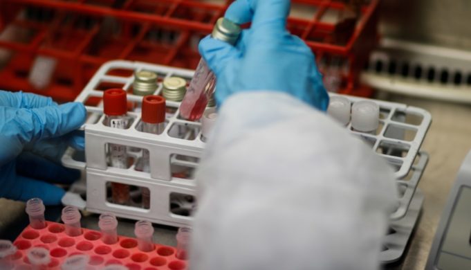 Λάρισα: Ανησυχία μετά τον εντοπισμό ασθενή με κοροναϊό ο οποίος παραβρέθηκε σε γάμο