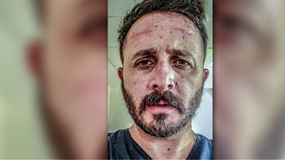 Συγκλονίζει ακτινολόγος του ΠΑΓΝΗ: «Τη μάσκα που αρνείσαι να φορέσεις, εμείς παρακαλάμε να την έχουμε»