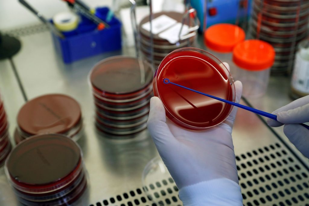 Κοροναϊός – ΠΟΥ: Πιθανόν να έχουμε εμβόλιο μέχρι το τέλος του έτους