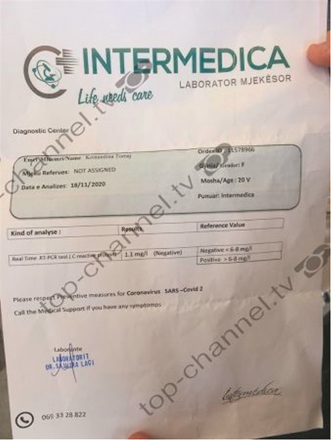 «Φάμπρικα» πλαστών τεστ για κοροναϊό στην Αλβανία