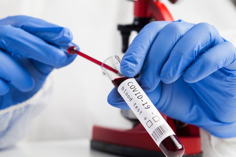 Κοροναϊός : Προς το τέλος του έτους η επιστημονική άποψη του ΕΜΑ για τα εμβόλια