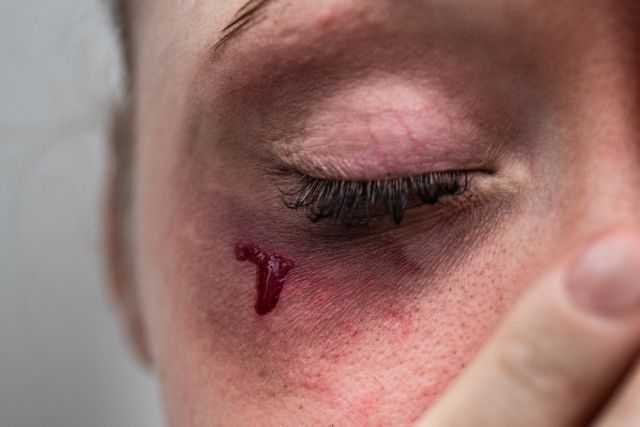 Ενδοοικογενειακή βία : Εκθεση-σοκ δείχνει ότι τετραπλασιάστηκαν οι καταγγελίες μέσα σε μια δεκαετία | tanea.gr