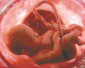 Μελέτη – σοκ: Μικροπλαστικά ανιχνεύθηκαν σε πλακούντες!