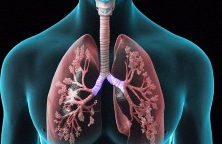 Κοροναϊός: Τι πρέπει να προσέχουν οι ασθενείς με χρόνια αποφρακτική πνευμονοπάθεια | tanea.gr