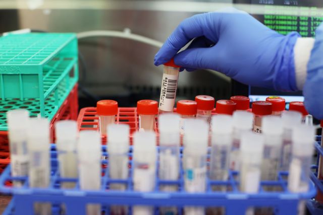 Κατά 84% αυξήθηκαν τον Φεβρουάριο τα τεστ