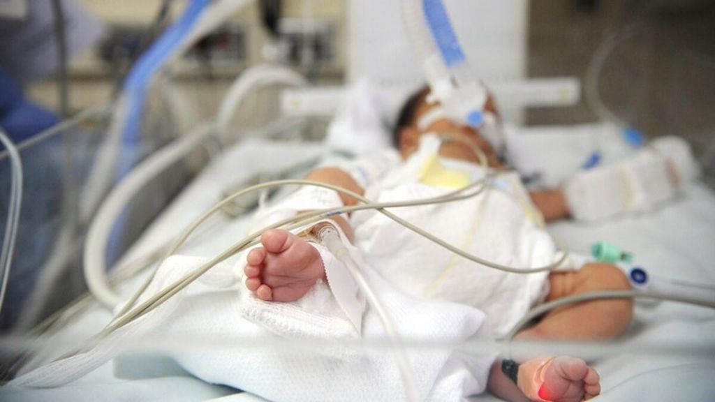Η συγκίνηση Κικίλια για το βρέφος 24 ημερών που βρίσκεται διασωληνωμένο