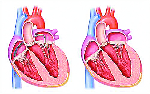 ΚΑΡΔΙΟ… ΓΡΑΦΗΜΑΤΑ